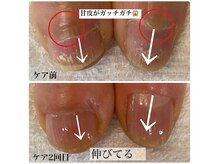 ココモ(cocomo)/ガチガチの甘皮凄い、、、