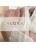 【美容皮膚科提携フェイシャル】繰り返す大人ニキビケアコース¥13200→¥9900