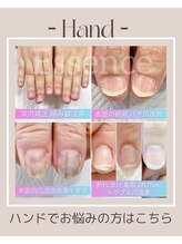 エッセンス (Essence)/Handのお悩みもご相談ください◎