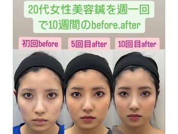 ゆうはり鍼灸整骨院 恵比寿