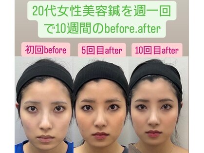 ゆうはり鍼灸整骨院 恵比寿の写真