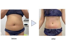 クリアプラス 小禄店(Clear+)/エルフィーノ50分