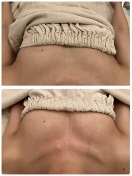 美人バスト 柏店/【バストアップ・育乳】症例