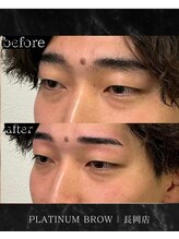 プラチナムブロウ 長岡店(PLATINUM BROW)/美眉スタイリングのお客様　20代