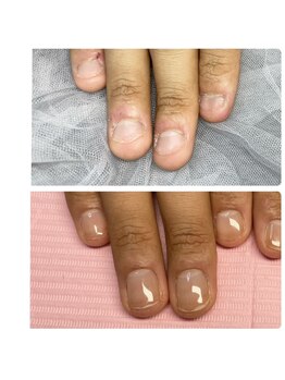 リベルタ(Liberta)/爪育