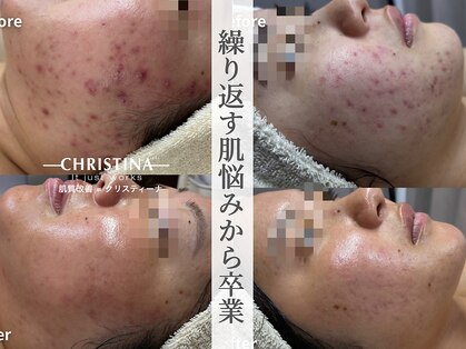 ココリールの写真