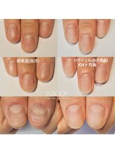 ニコプラス(NICO+)/