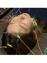 リード整骨院/小顔に！リフトＵＰ★