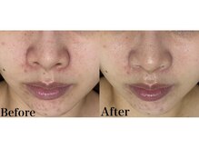 マスカレード 品川(Masquerade)/