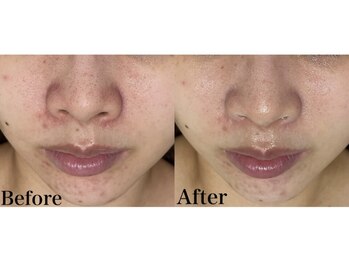 マスカレード 品川(Masquerade)/