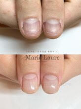 マリーロール 梅田店(Marie Laure)/深爪矯正/自爪育成/自爪風