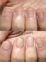 マリーロール 梅田店(Marie Laure)/深爪改善/自爪育成/ネイルケア