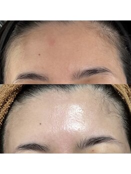 ジューンブライド(June Bride 61)/肌改善プログラム