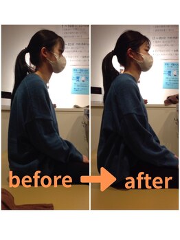 若松整体院/ビフォーアフター(2)