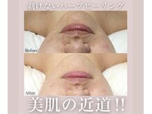 アトランティカ(ATLANTICA)/