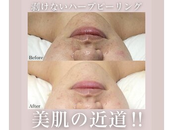 アトランティカ(ATLANTICA)/