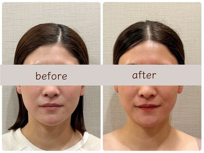 ナツメ鍼灸院(natume鍼灸院)の写真