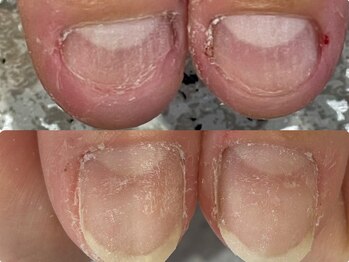 グレースレディ 神戸北店/