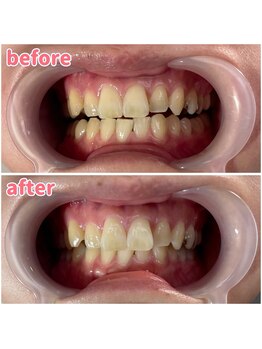 パルティービューティー 天満店(PARTIE BEAUTY)/お客様の変化をお届け【No.7】