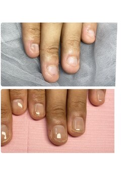 リベルタ(Liberta)/爪育