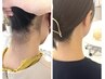 [うなじシェービング]シェービング&うなじ矯正！うなじ矯正"1500円"