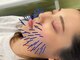 モンダロ(MONDARO)の写真/美容鍼でツルスベ肌に！エステとは一味違う！たるみケアで目指す小顔体験が人気です★