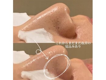 サロンドゥルシエル/オリジナルハーブ