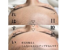 リグレイス(Re.Grace)の雰囲気（当店一番人気メニュー！フェイスワックス6000円～）