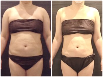 ウェリナ平和堂長久手院/小顔矯正/骨盤矯正/痩身/整体