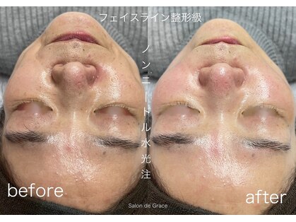 サロンドグレース(Salon de Grace)の写真