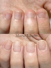 マリーロール 梅田店(Marie Laure)/深爪改善/自爪育成/ネイルケア