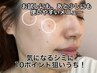 【今人気♪】お顔や手の甲、体も気になる10箇所選べるシミ改善ケア♪￥2800