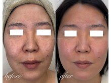 プライベートサロン コットン(COTTON)/ハーバルシー