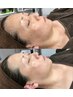 感動！ 老け顔【たるみ・ほうれい線・シワ】ケア 15400 →*8,800初回限定