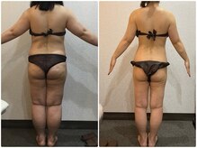 美容整体 ウェリナ 蟹江院/小顔矯正/骨盤矯正/美脚サロン 