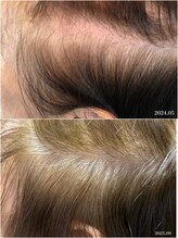 ヒルナム(Heal Nam)/プロセルセラピーズ~頭皮~