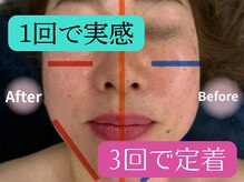 アネム(Anemu lune)