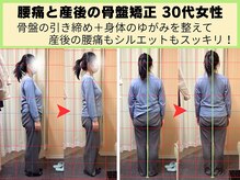 鍼灸 整体院 ひわたし/産後の骨盤矯正・腰痛もOK