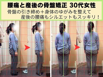 鍼灸 整体院 ひわたし/産後の骨盤矯正・腰痛もOK