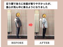 富雄みなみ整骨院/施術後ビフォーアフター