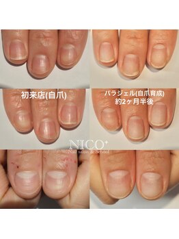 ニコプラス(NICO+)/