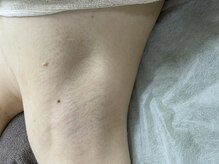 ナノハナ/鹿沼市全身脱毛美容室ナノハナ