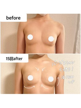 つばききよら/バストの輪郭くっきり！谷間も