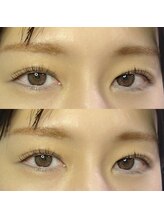 ジョリー(Jolie)/