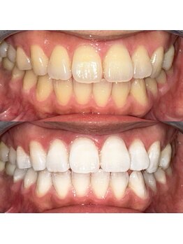 ライトビューティー 池袋店(LightBeauty)/症例写真