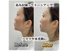 【韓国でも話題最新マシン！】水光艶肌リフティング+AIお肌診断9800円☆