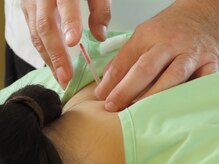 小笠原鍼灸接骨院/鍼灸［所沢/下山口］