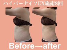 エステサロン ヴリエ 立川店の雰囲気（【下っ腹】【うきわ肉】は腸内環境が原因かも？芯から改善★）