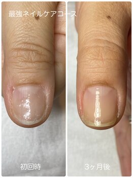 ネイルブルームーン(Nail Blue Moon)/最強ネイルケアコース