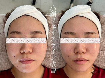 フレキシ 表参道(Flexi)/小顔矯正＋肩こり整体、骨盤矯正